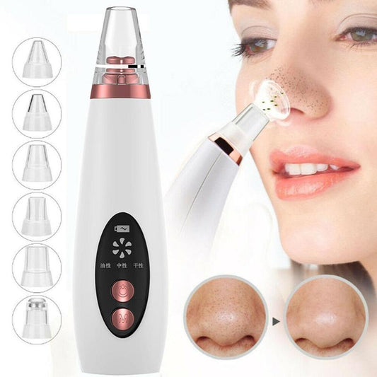 Blackhead Pore Vacuum Cleaner Nose Cleanser Blackheads Remover Blackhead Acne Removal Button Face Suction Beauty Skin Care Tool - Electronic Supreme